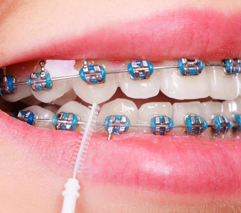 Projeto financiou tratamentos dentários a 10 doentes com cancro no Alto Tâmega