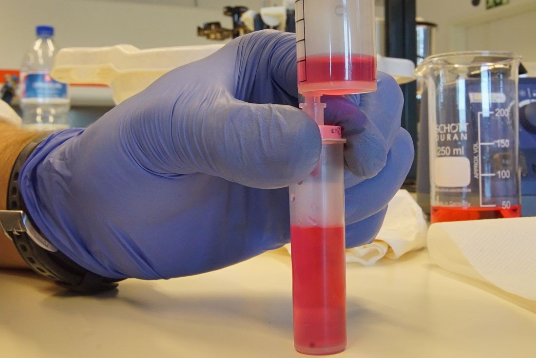 UTAD usa tecnologia do DNA dos vinhos para a deteção rápida do COVID-19